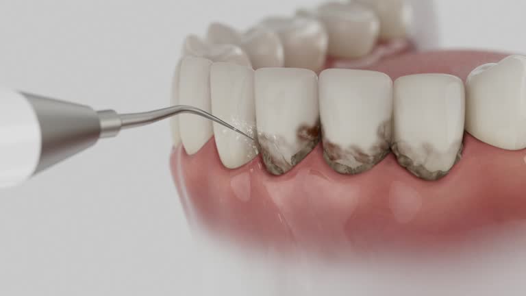 Reliable Dental Implants contractor in Aventura, FL by Smile Center Dentistry